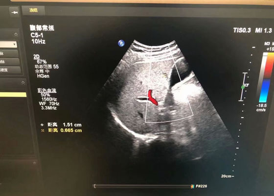 Philip C5-1 Abdominal Medical Ultrasound Probe For EPIQ 5 device